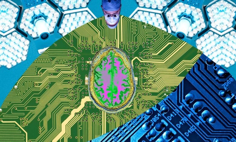Your Next Job: Brain-Computer Interface Surgeon
