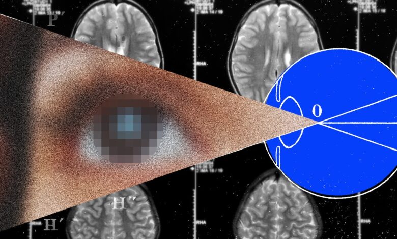 The Next Frontier for Brain Implants Is Artificial Vision