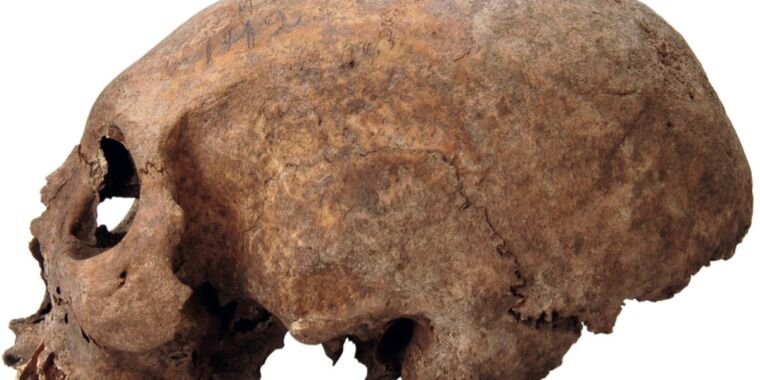 Study: Three skulls of medieval Viking women were deliberately elongated