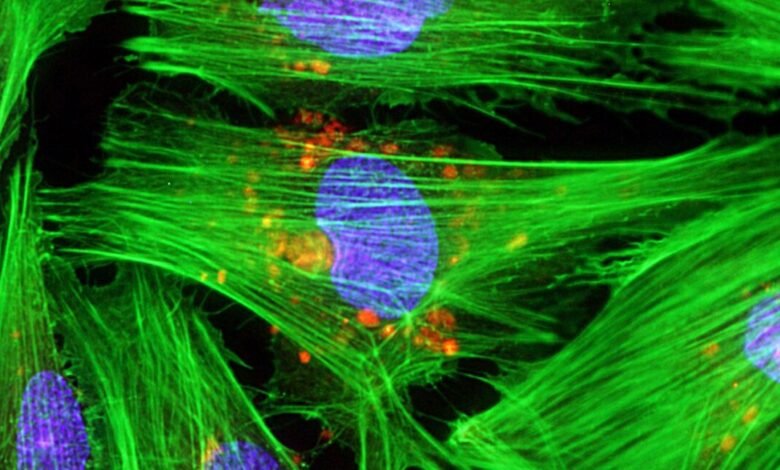 Stem cells used to partially repair damaged hearts Stem cells used to partially repair damaged hearts