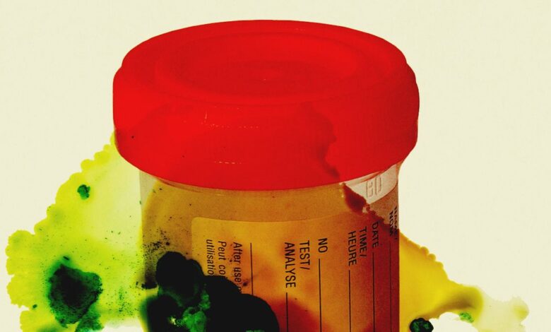 Thousands of Urine and Tissue Samples Are in Danger of Rotting After Staff Cuts at a CDC Laboratory Thousands of Urine and Tissue Samples Are in Danger of Rotting After Staff Cuts at a CDC Laboratory