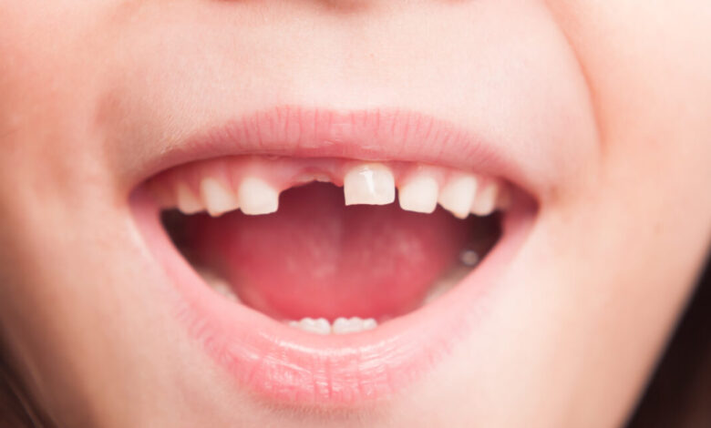 RFK Jr’s plan to ban fluoride supplements will “hurt rural America,” dentists say RFK Jr’s plan to ban fluoride supplements will “hurt rural America,” dentists say